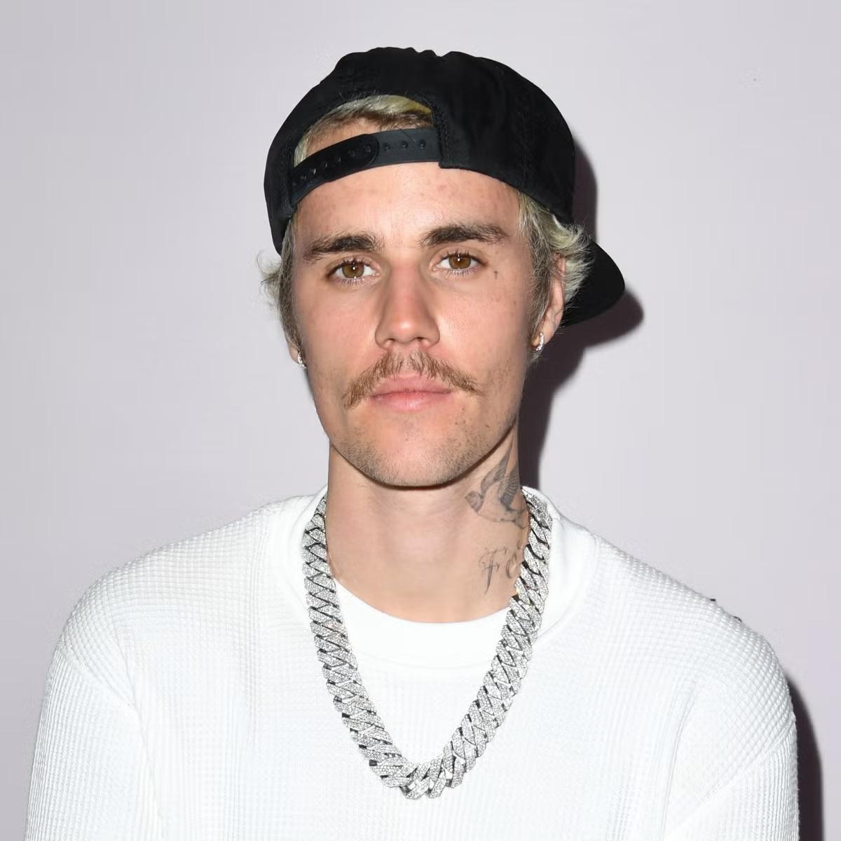 Justin Bieber admits he is broken, talks about having anger issues.