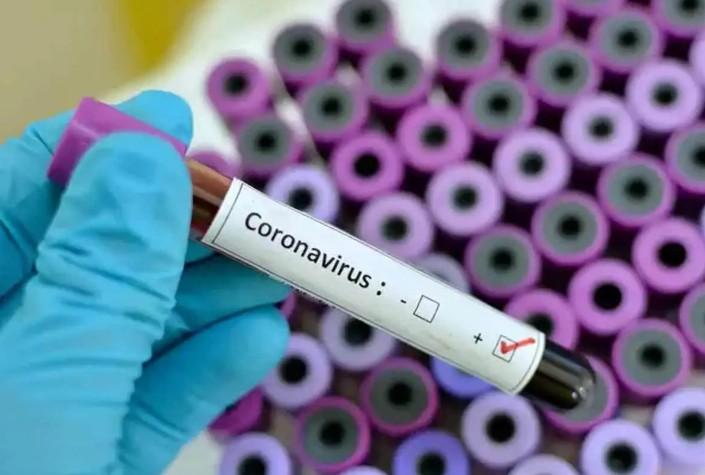 K'taka govt directs authorities to stock up Covid-19 testing kits