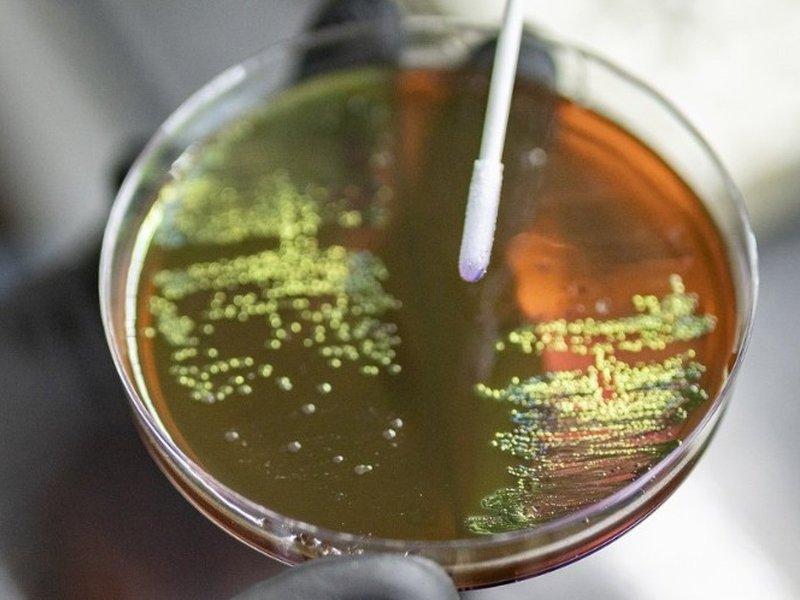 High superbug load in Delhi environment posing public health risks: Study
