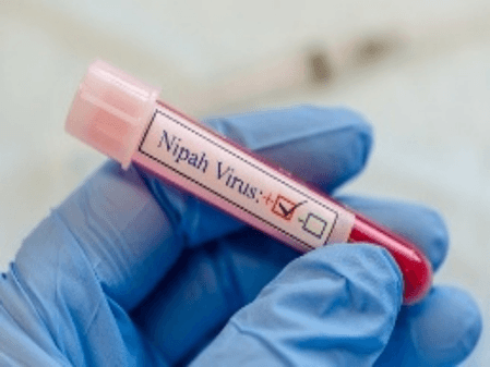 First Nipah virus death reported in Bengal