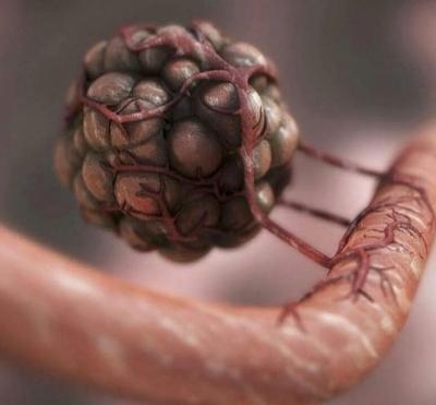 Researchers find genetic fingerprints to predict efficacy of immunotherapy