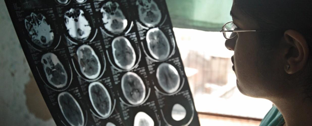 More than 1 in 3 people worldwide live with brain disorders, 11 million die annually: Report