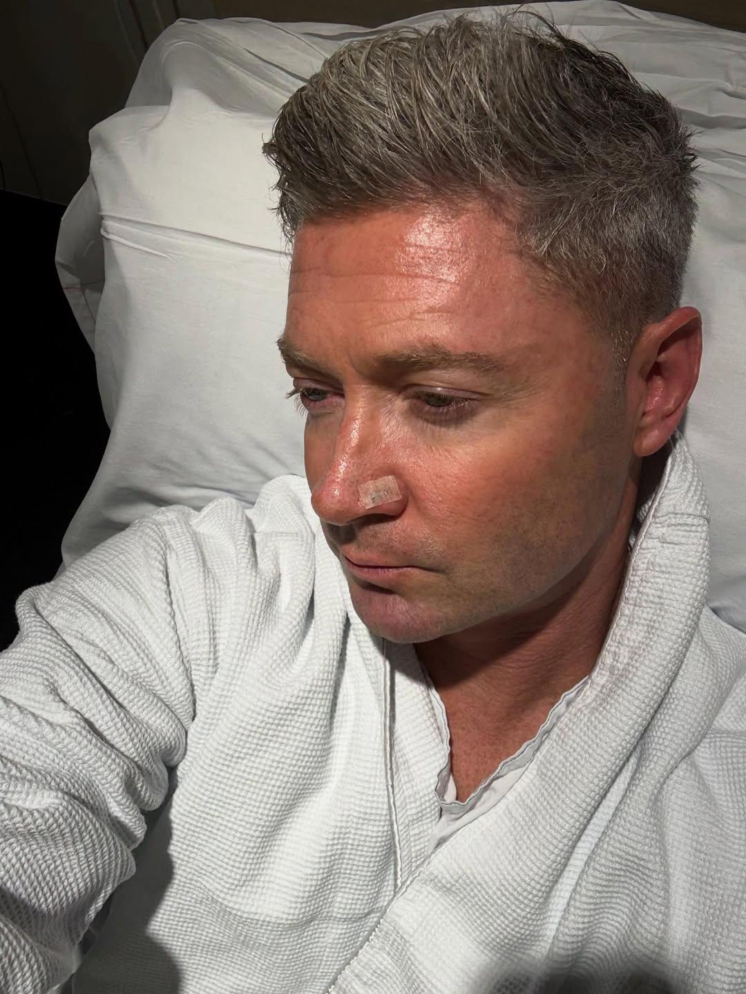 'I've had seven basal cells cut out of my face': Michael Clarke on his battle with skin cancer