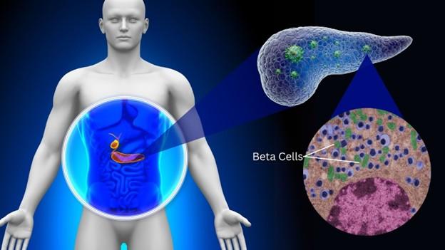 IIT Bombay study finds protein abundant in human body worsening diabetes
