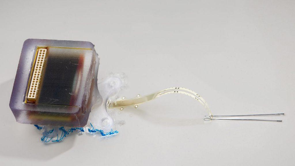 Implantable electronic device restores movement after spinal cord injury