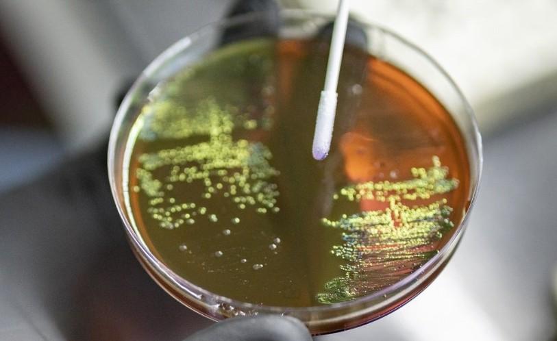 Why is antimicrobial resistance not just future threat, but a present reality