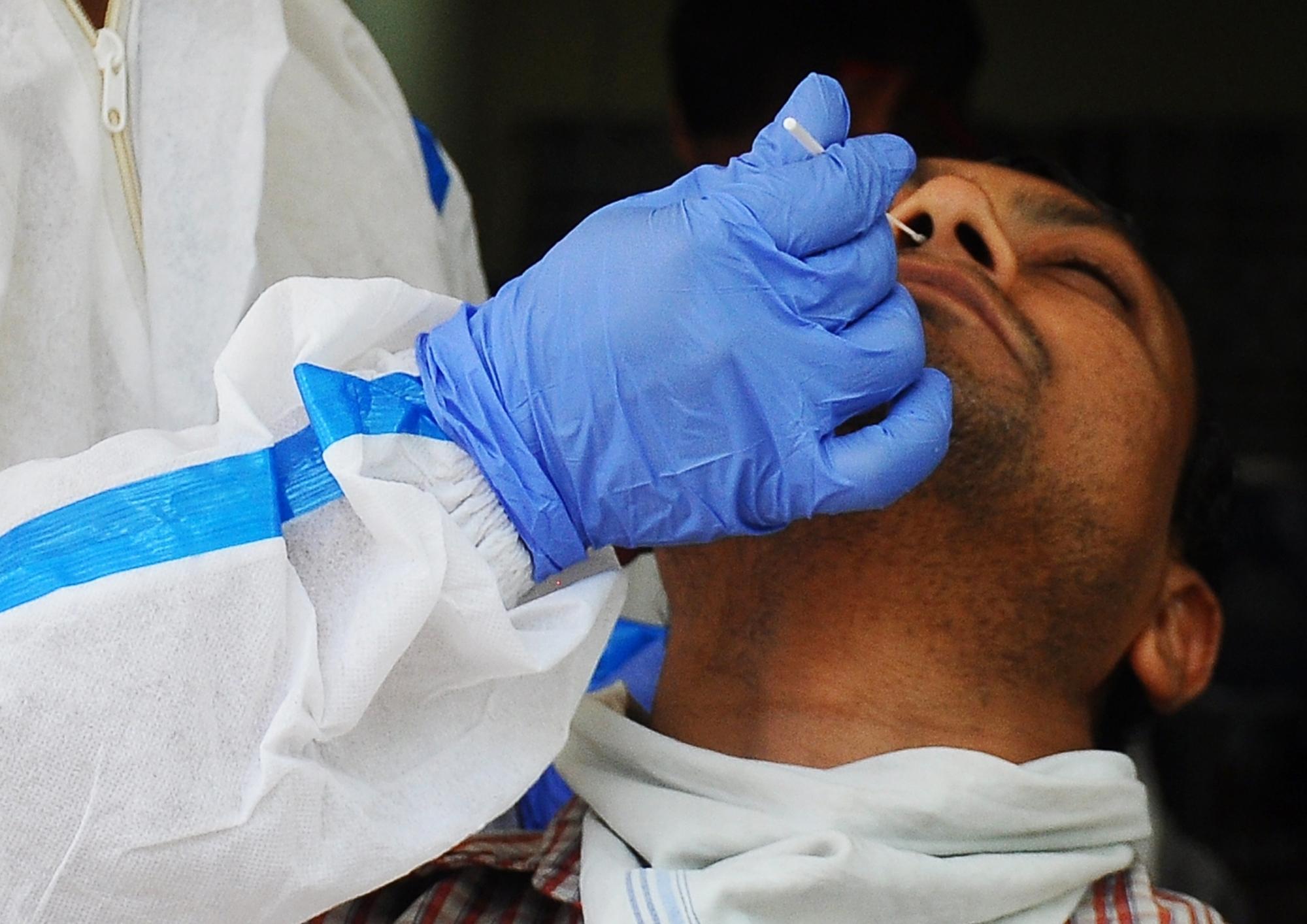 Loss of smell may linger for years after Covid-19: Study