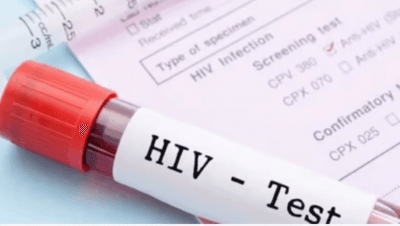 424 living with HIV/AIDS in Mongolia
