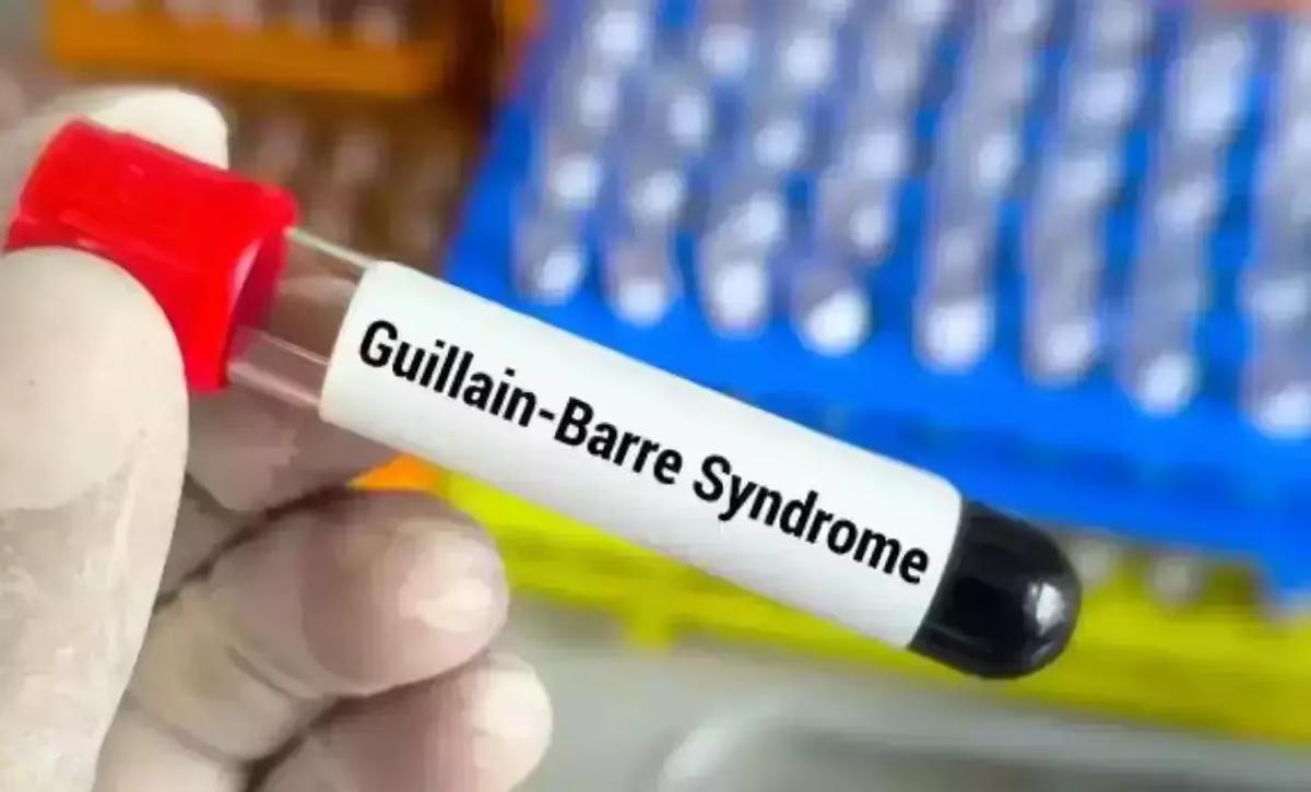 Guillain-Barre Syndrome