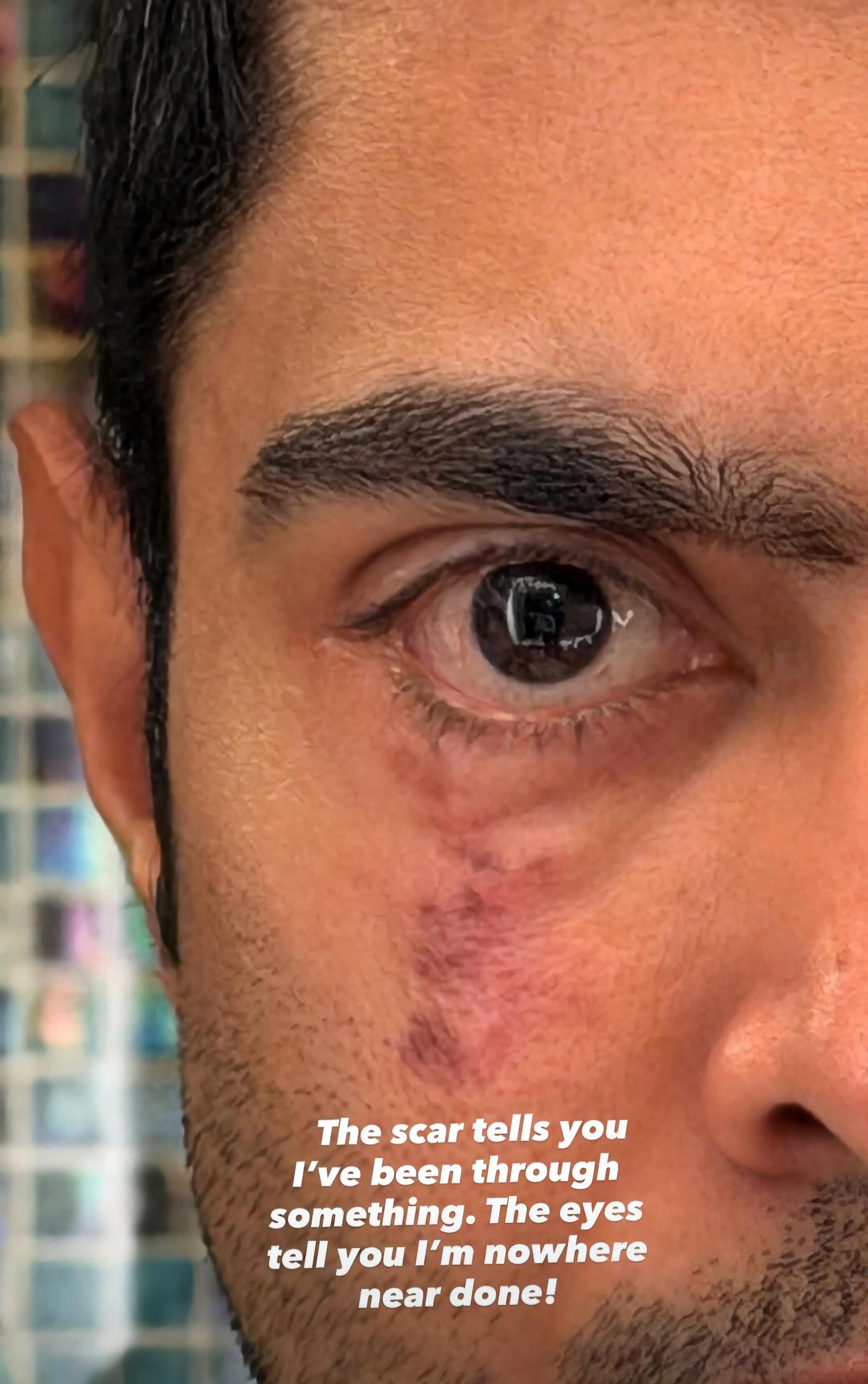 Abhishek